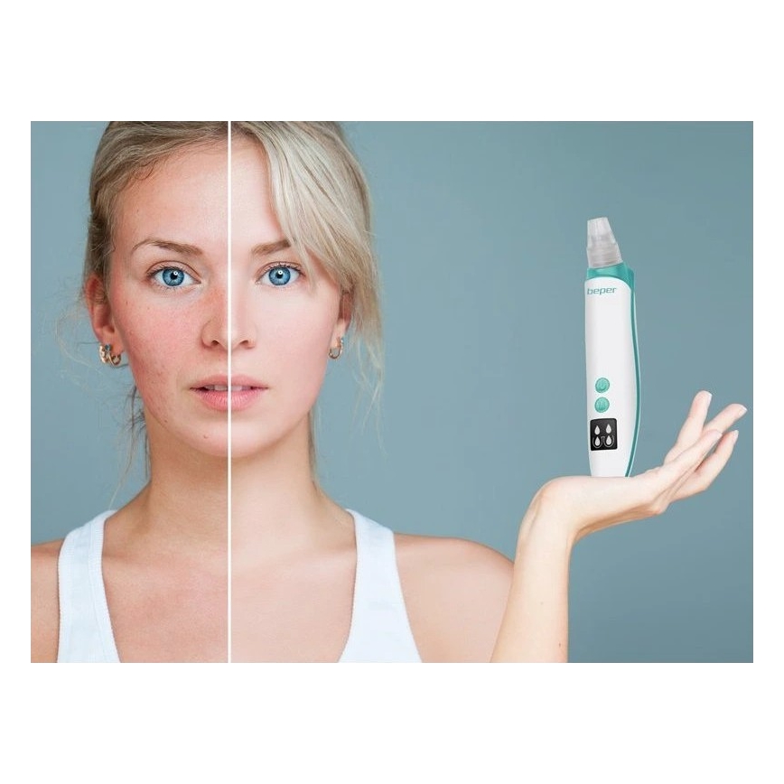 Beper - Wiederaufladbarer Porenreiniger USB/5V 400 mAh